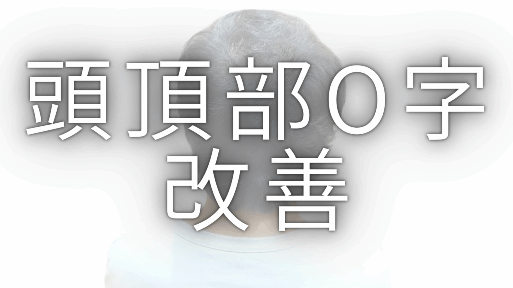 M字ハゲに似合う髪型5選｜カットの原則からセット手順まで薄毛専門美容師が解説 - AGA薄毛の悩みを解決する美容師ブログ｜M字・O字・U字の ...