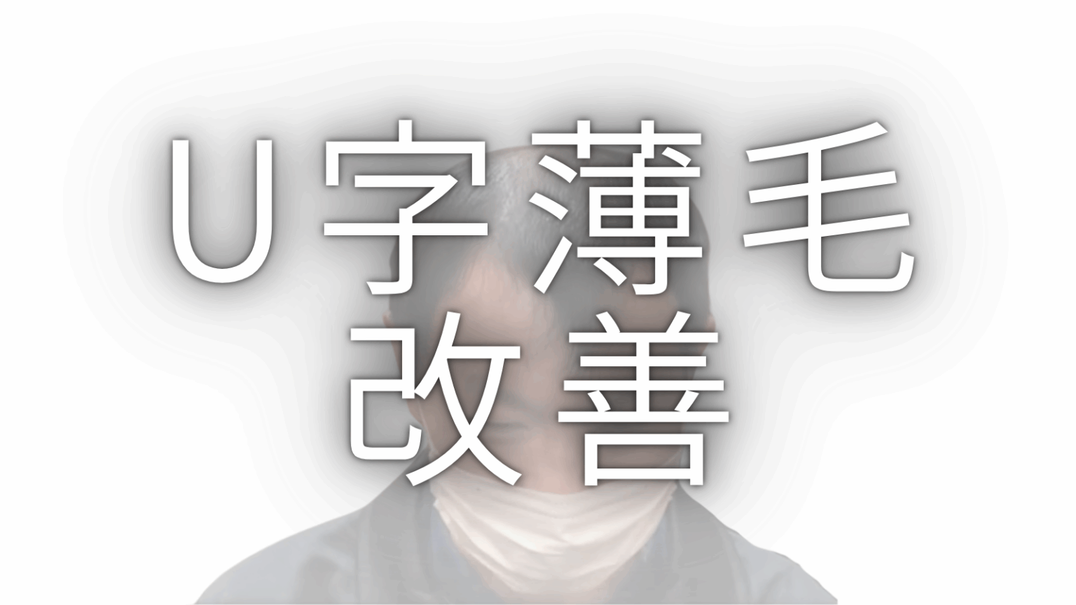 M字ハゲに似合う髪型5選｜カットの原則からセット手順まで薄毛専門美容師が解説 - AGA薄毛の悩みを解決する美容師ブログ｜M字・O字・U字の ...