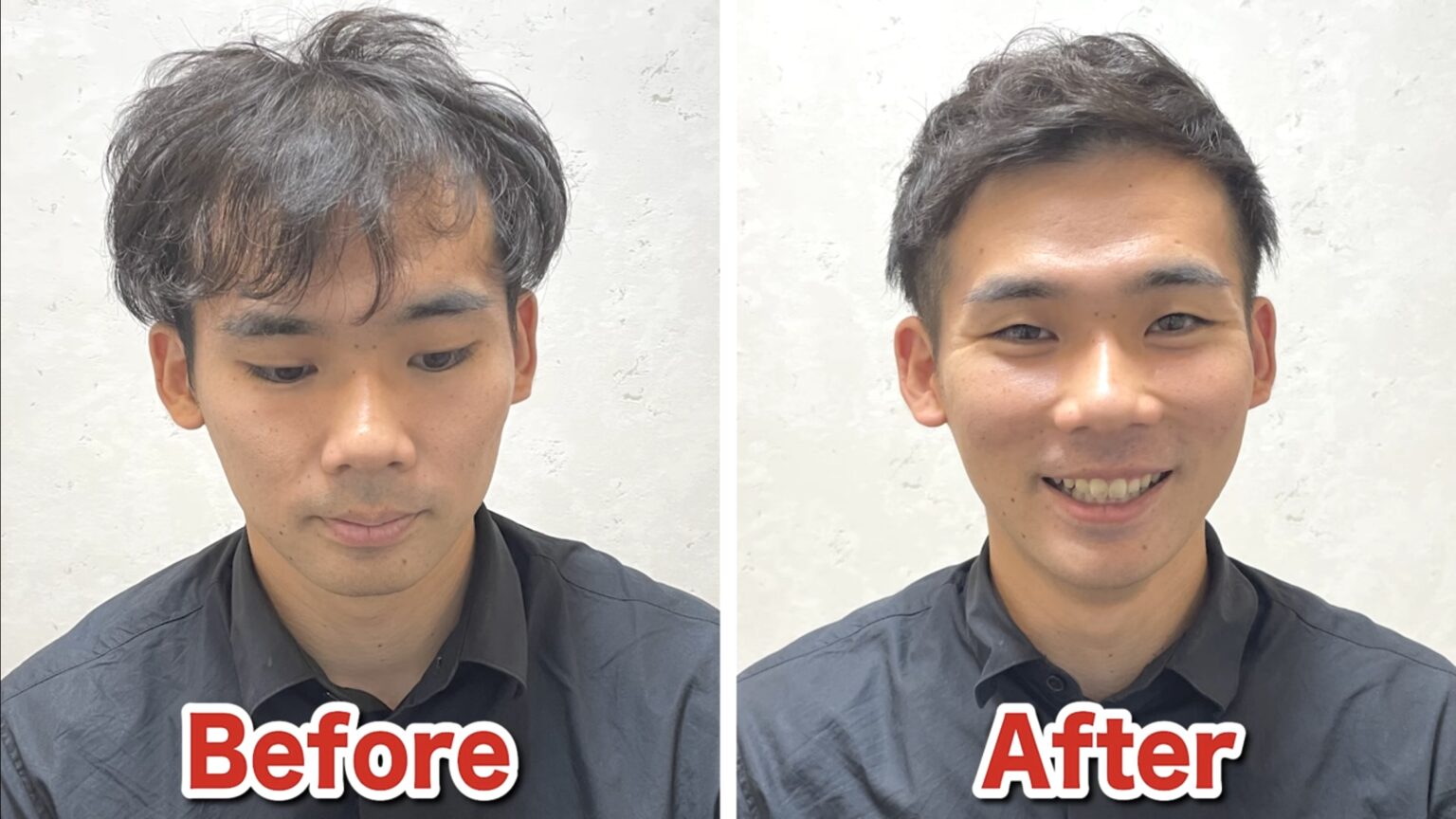 M字ハゲに似合う髪型5選｜カットの原則からセット手順まで薄毛専門美容師が解説 - AGA薄毛の悩みを解決する美容師ブログ｜M字・O字・U字の ...
