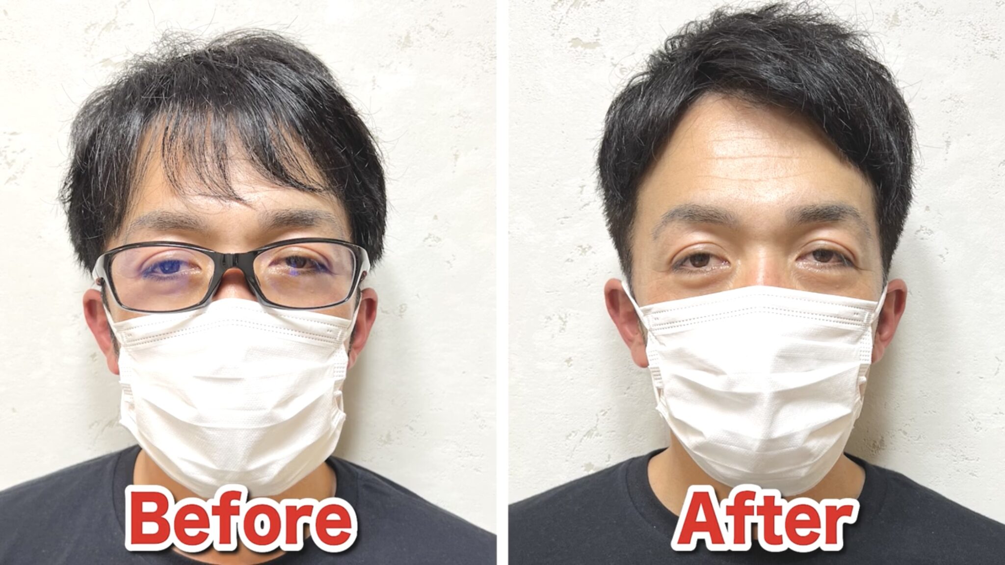【薄毛専門美容師解説】M字ハゲに似合う髪型5選｜カット＆セット完全ガイド - AGA薄毛の悩みに寄り添う美容師ブログ｜M字・O字・U字の髪型や ...