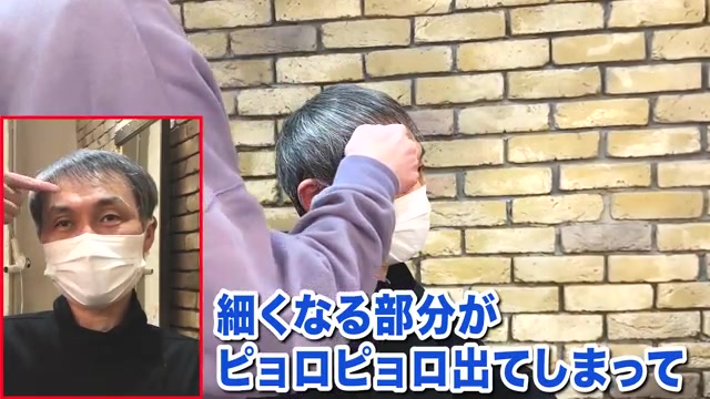 RELIVEのM字薄毛カット施術
