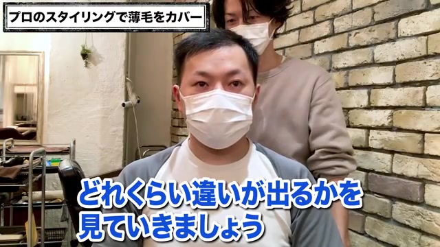 RELIVEの生え際薄毛施術