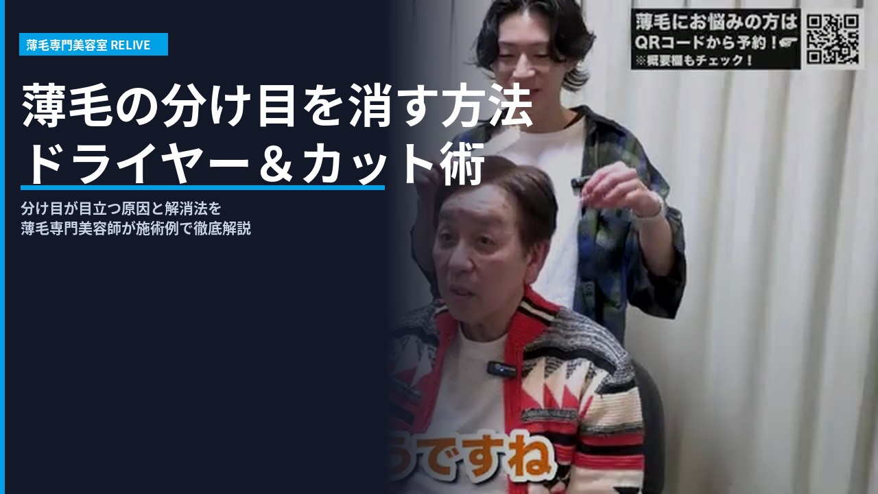薄毛の分け目カウンセリングシーン - RELIVE