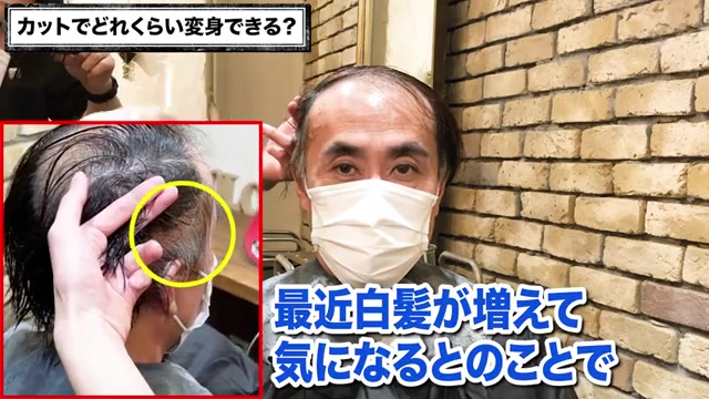 O字M字薄毛のカット施術|RELIVE薄毛専門美容室