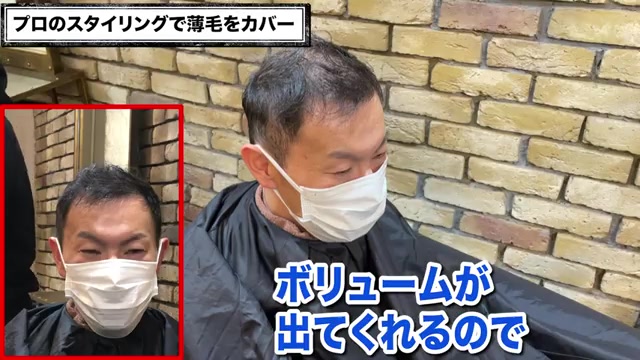 頭頂部薄毛ドライヤーセット施術