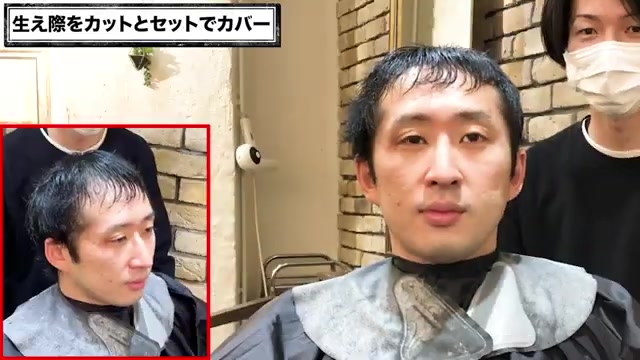 生え際薄毛カット施術中