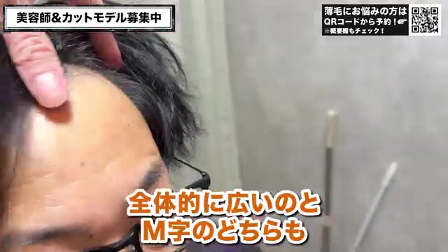 薄毛・M字の生え際を確認するカウンセリング - RELIVE