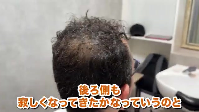 AGA薄毛のスタイリング仕上がり｜RELIVE