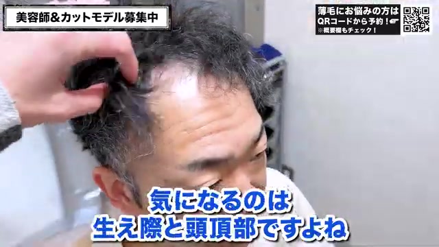 U字ハゲのカウンセリング風景|RELIVE薄毛専門美容室